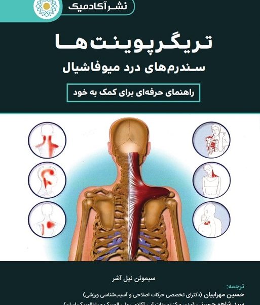 تریگرپوینت ها